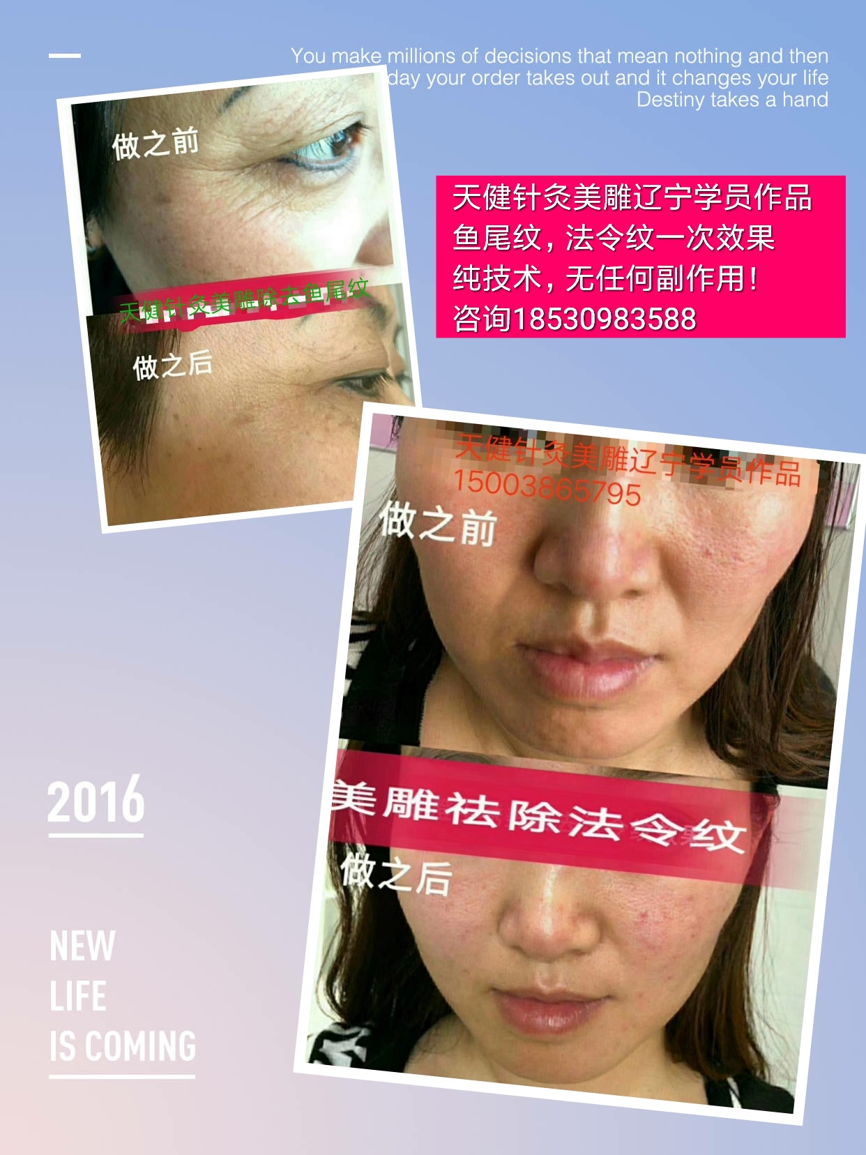 太原绝技减肥有效果吗乔小平针灸美雕