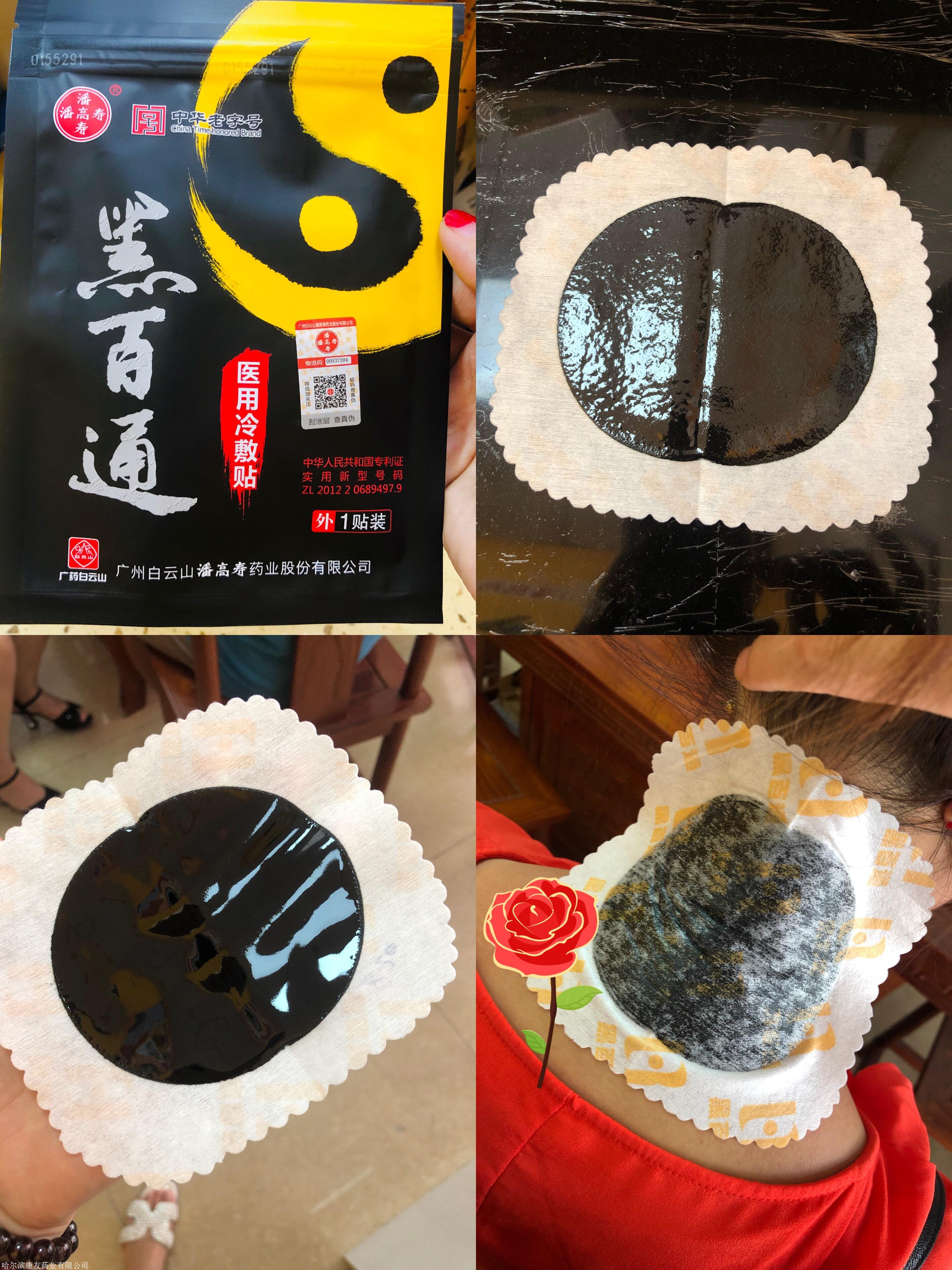 黑百通有什么效果严重颈椎病贴几贴能好