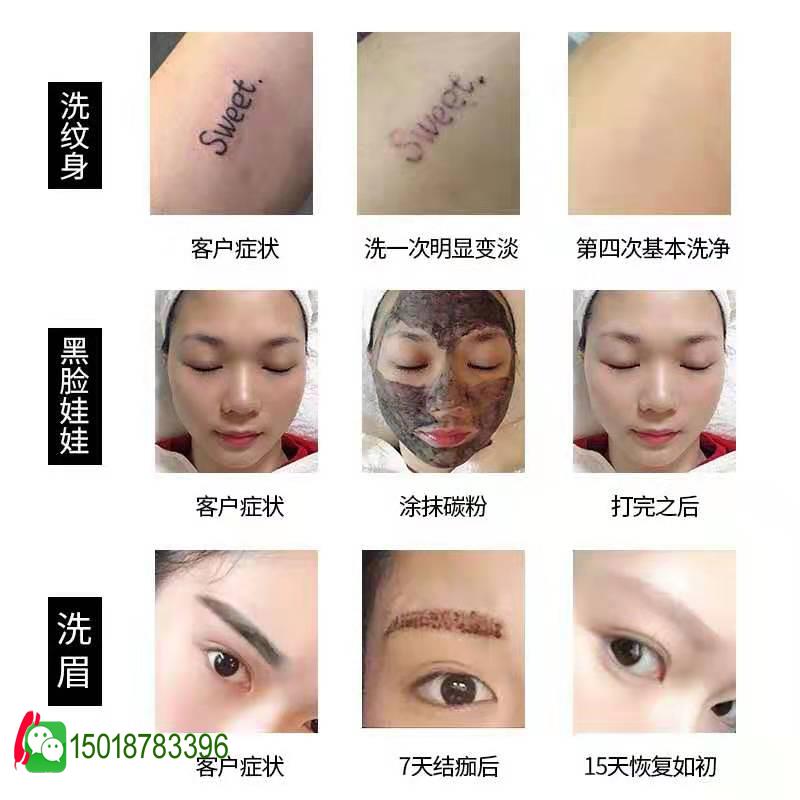 广州洗眉机生产厂家,洗眉机洗眉后注意事项,洗眉后多久可以沾水