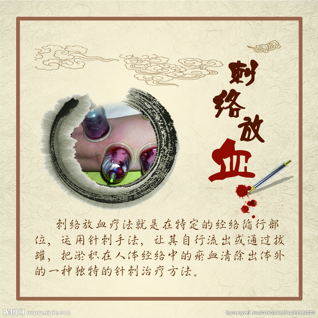 刺络放血培训拉萨正宗针灸疗法培训