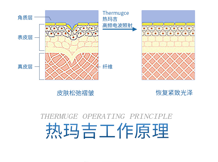 美容仪器厂家直销第五代液氮版热玛吉价格实惠