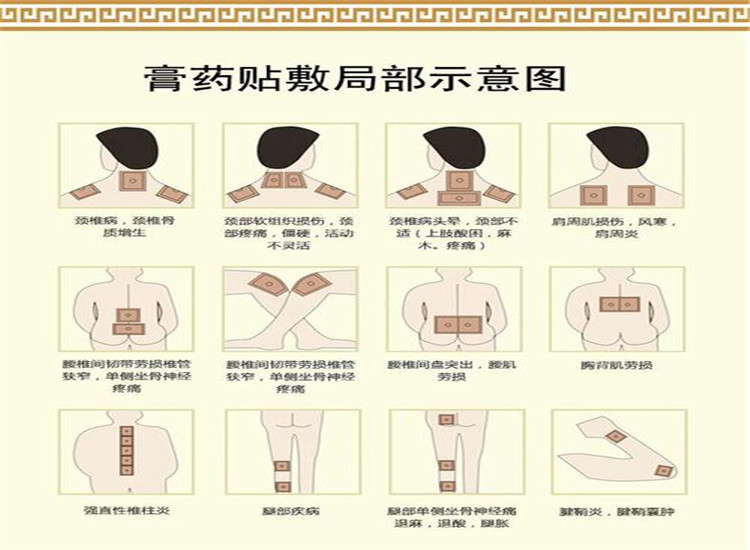 发热包 膏药贴-三伏贴空贴