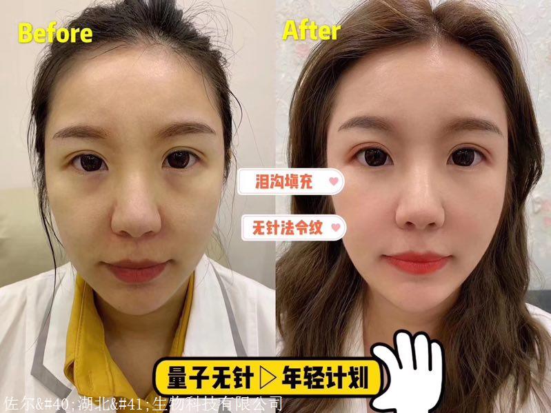 佐尔创美五官塑好不好