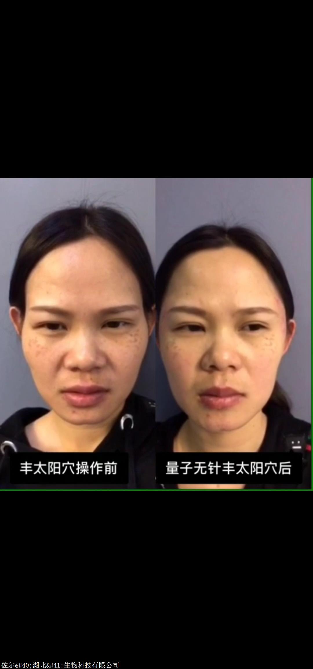 佐尔创美五官塑好不好