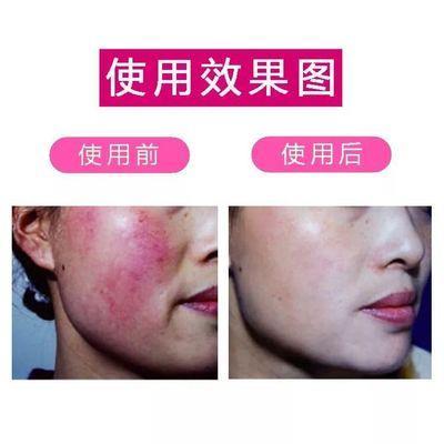 电商祛红血丝修复乳oem贴牌加工厂家