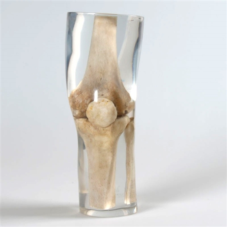 德国夸特QUART X射线膝盖模型 膝关节模型