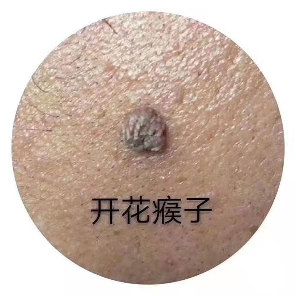 加盟祛斑招商加盟