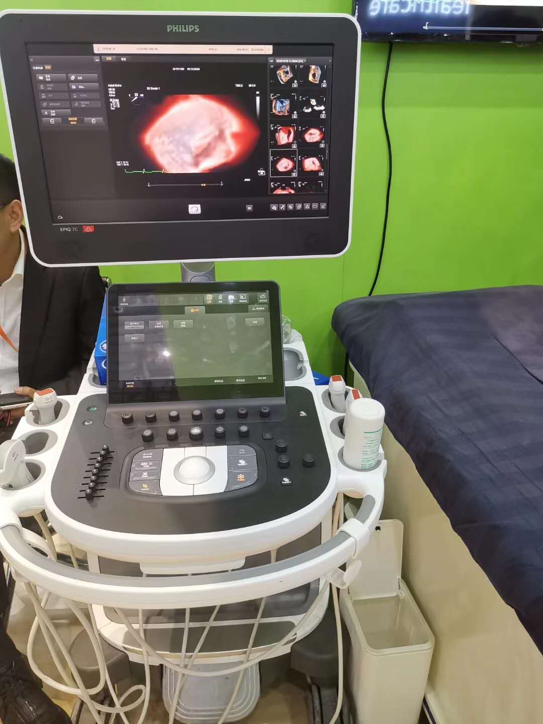飞利浦儿童心脏彩超 飞利浦epiq 7心脏彩超代理商