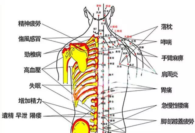 腰椎拔罐的位置图片图片