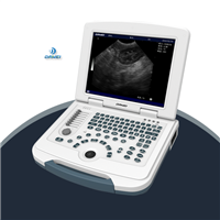兽用b超机 兽用超声诊断仪 便携式b超机