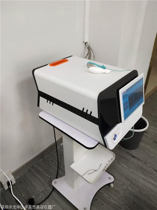 盆底肌治疗探头怎么收费