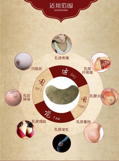 月姿韵乳腺贴临床收费 医保乳腺贴代理价格