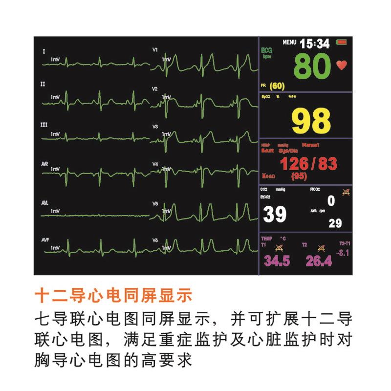 寶萊特多參數監護儀btd352a國產監護儀