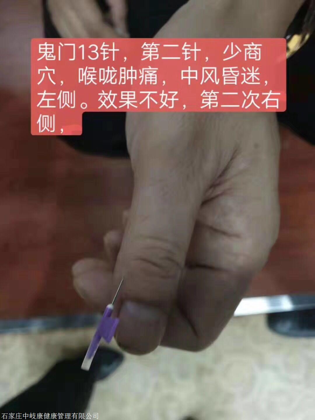 鬼门十三针无痛针灸培训