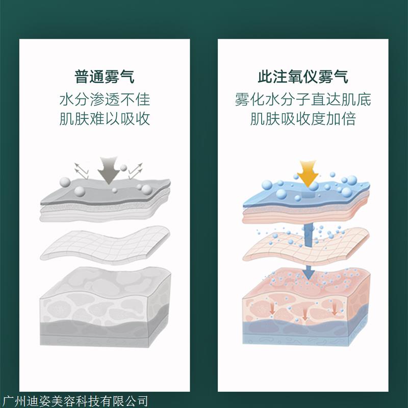 手持家用注氧仪工作原理 家用纳米喷雾仪补水效果好