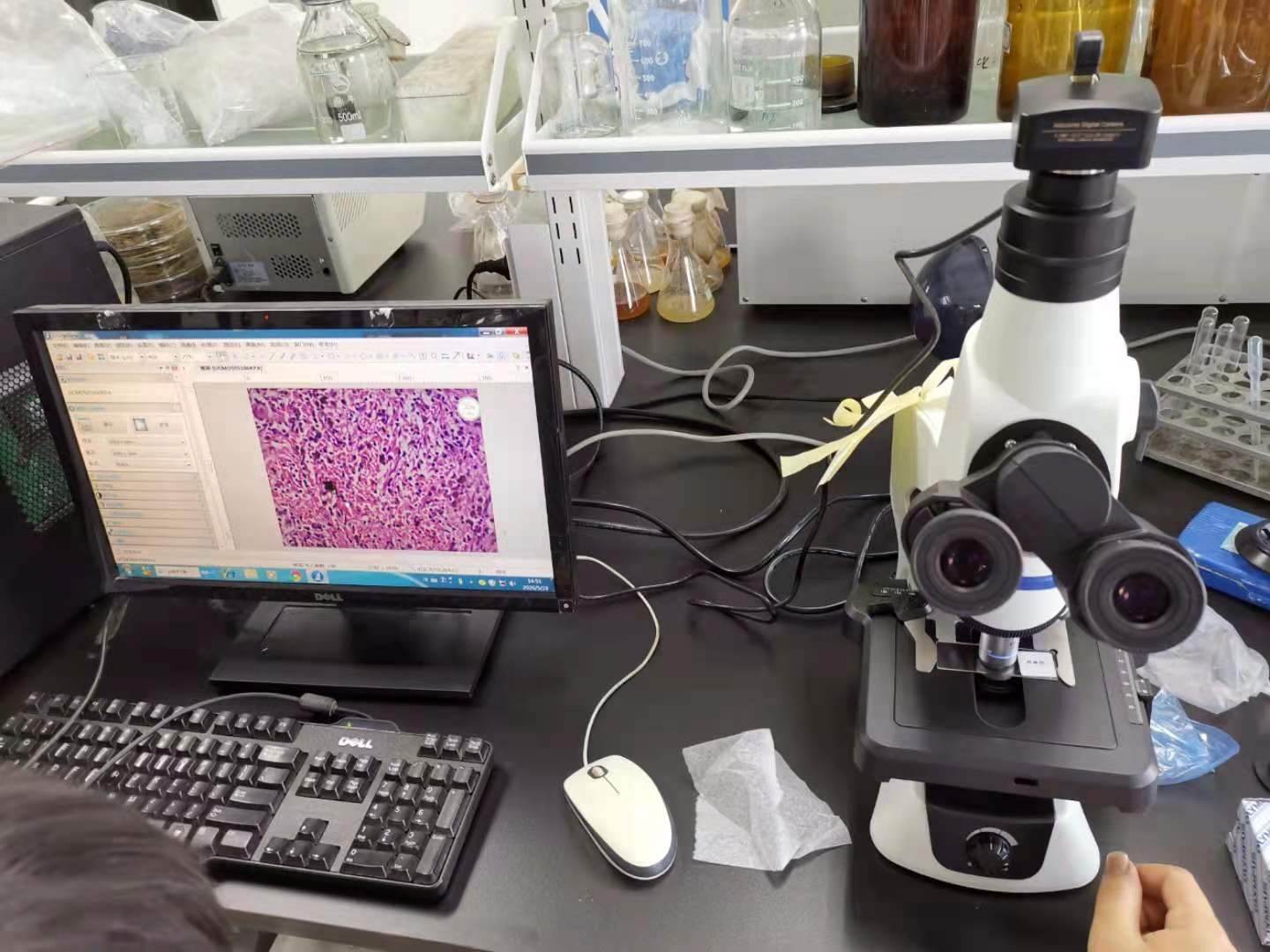 日本尼康e100生物顯微鏡切片細胞觀察可升級熒光成像系統