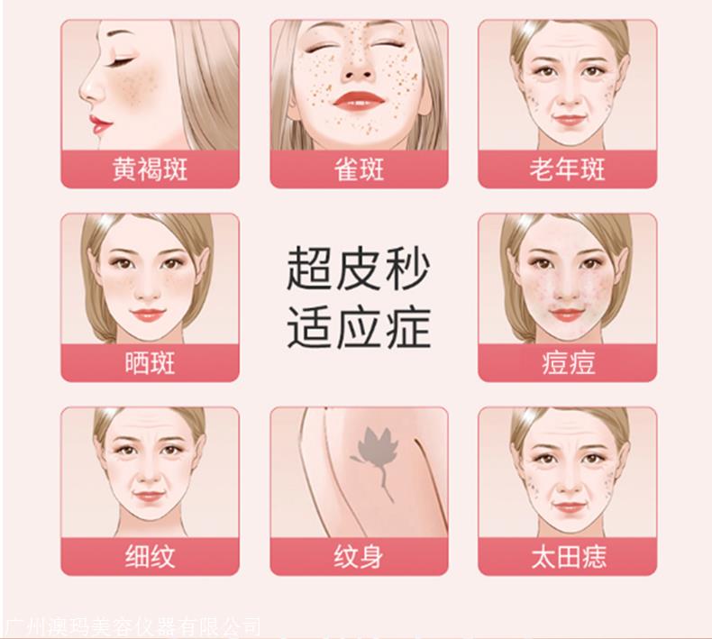 超皮秒进口品牌多少钱 超皮秒净斑嫩肤ManBetX万博下载销售总代理