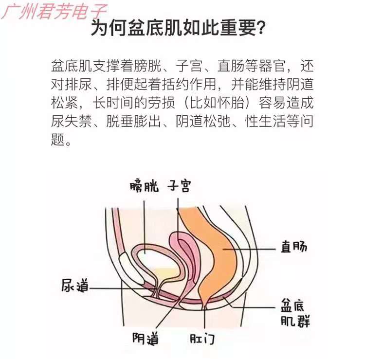 盆骨修復儀香港第五代盆底肌修復儀廠家激活盆底肌