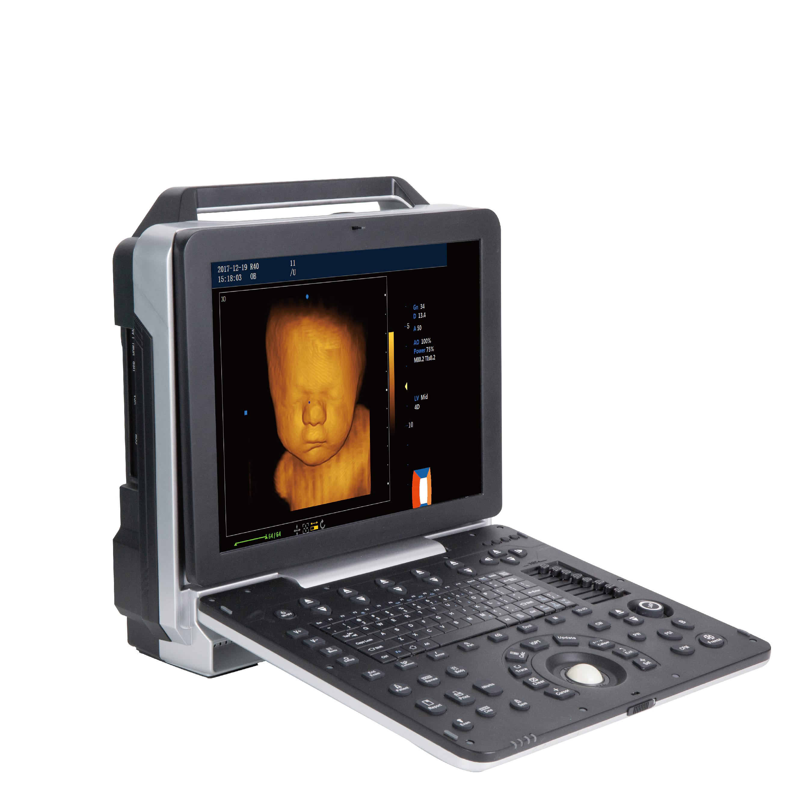 手提式彩超机 江门普通b超机批发价格