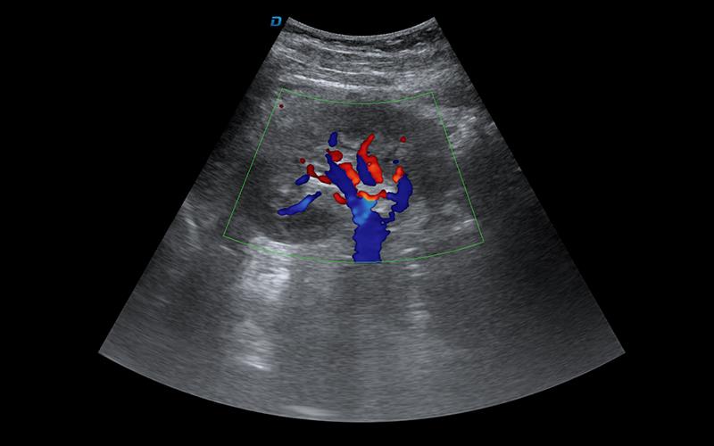 推车四维彩超机南京全数字彩超机厂品质保障