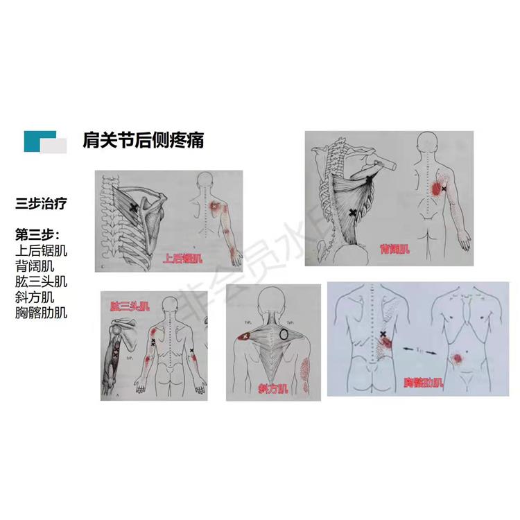 广西中医柔性正骨好学吗